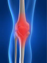 Knee Inflammation Total Therapy Burnaby Physiotherapy Vancouver