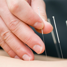 Acupuncture Cleanse Total Therapy Physiotherapy Burnaby Vancouver