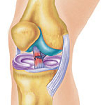 ACL Tear Total Therapy Physiotherapy Burnaby Vancouver