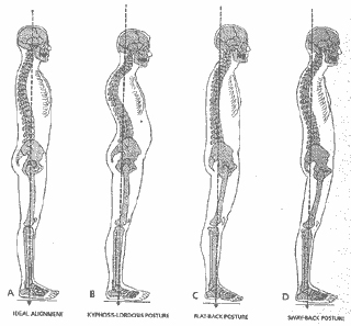 Postural Alignment Total Therapy Physiotherapy Massage Therapy Burnaby